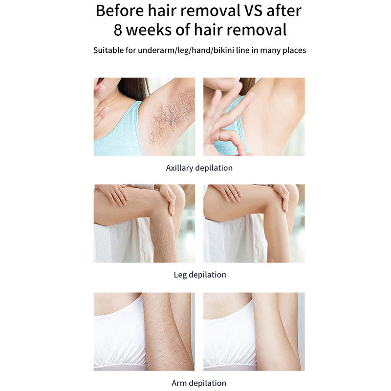 Ice Cool IPL Hair Removal
